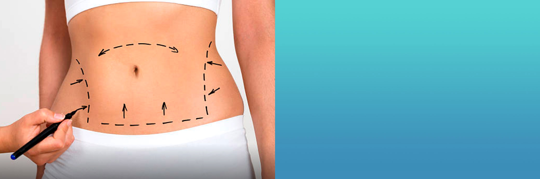 Tummy Tuck Surgery Honolulu Hawaii, Abdominoplasty